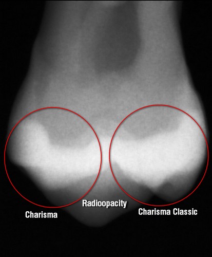 Charisma_radioopacity.jpg