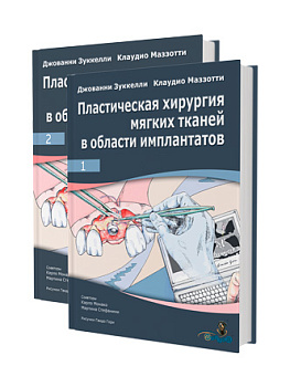 Пластическая хирургия мягких тканей в области имплантатов/Д. Зуккелли