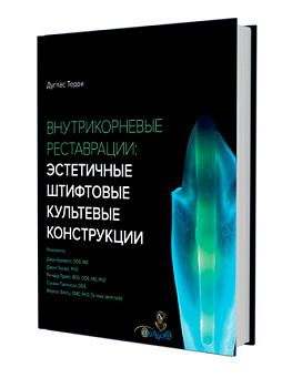 Внутрикорневые реставрации:эстетичные штифтовые культевые конструкции/Д. Терри