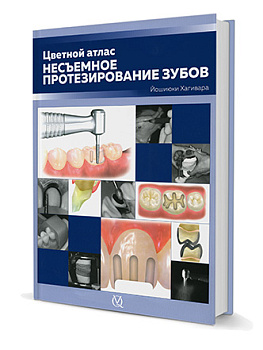 Несъемное протезирование зубов. Цветной атлас./Й. Хагивара