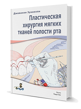 Пластическая хирургия мягких тканей полости рта./Д. Зуккелли