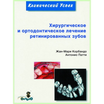 Хирургическое и ортодонтическое лечение ретинированных зубов / Ж. Корбендо