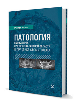 Патология полости рта в практике стоматолога/Р. Маркс