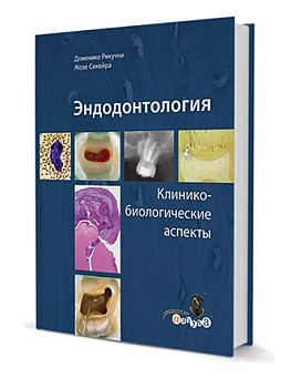 Эндодонтология. Клинико-биологические аспекты/Д. Рикуччи, Ж. Сикейра