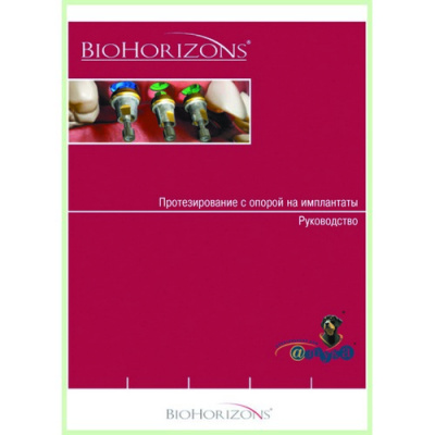 Протезирование с опорой на имплантаты / Руководство