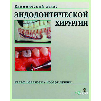 Клинический атлас эндодонтической хирургии  / Р. Беллиззи