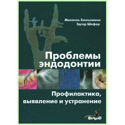 Проблемы эндодонтии. Профилактика, выявление и устранение / М. Хюльсман